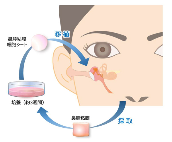 東京慈恵会医科大学との共同治験にて、耳鼻咽喉科分野で国内初の再生医療製品実用化を目指す