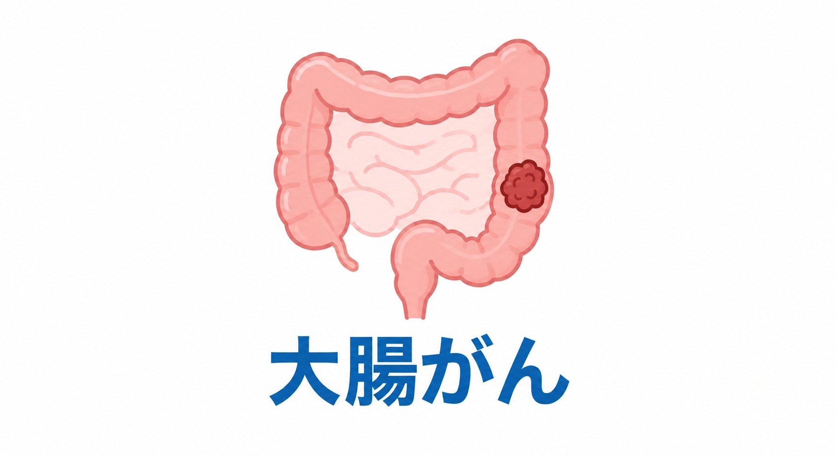 新しい大腸がん医療の可能性をひらくために
