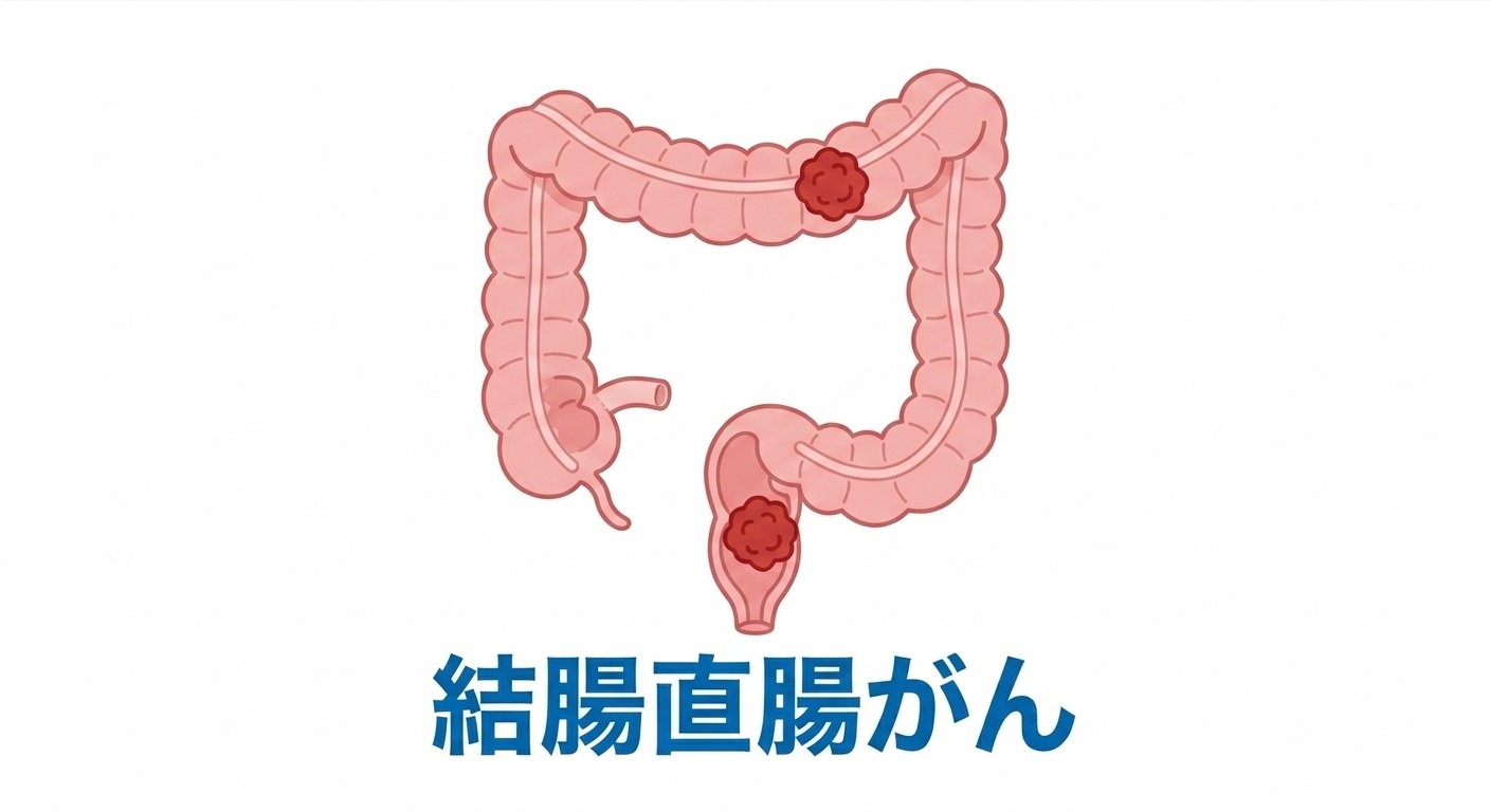 新しい結腸直腸がん医療の可能性をひらくために