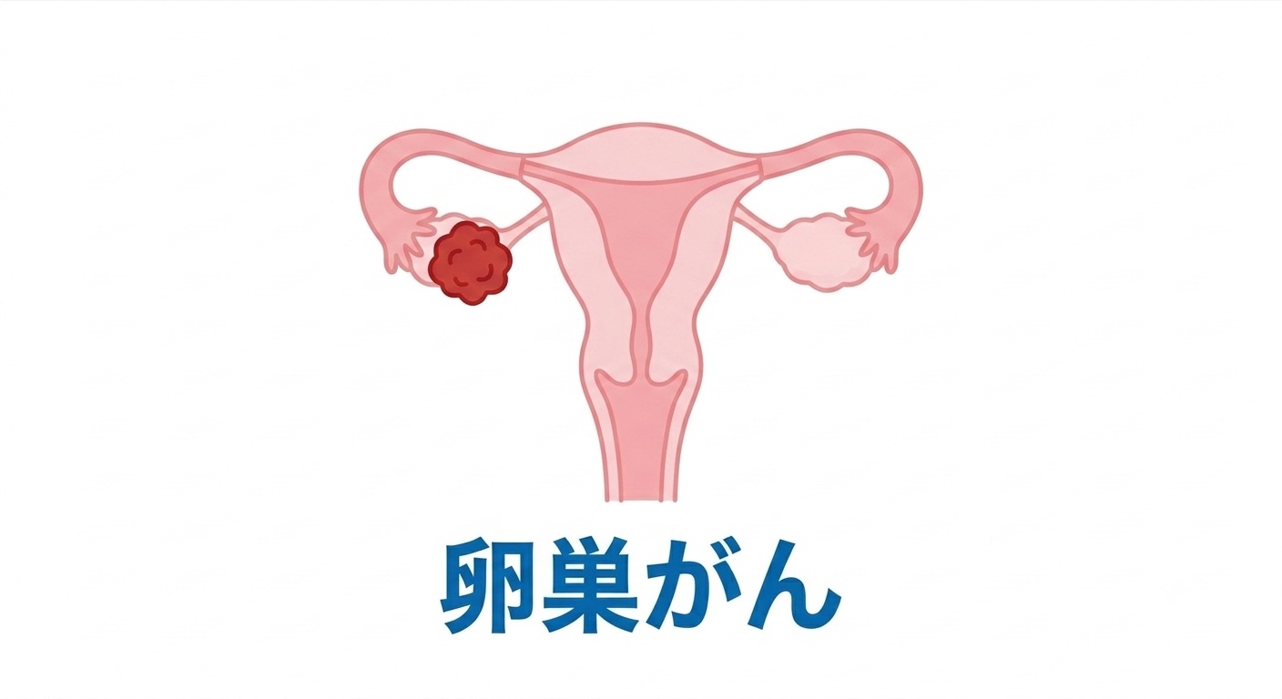 新しい卵巣がん医療の可能性をひらくために