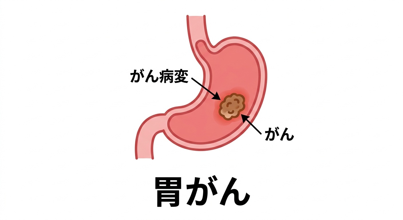 新しい胃がん医療の可能性をひらくために