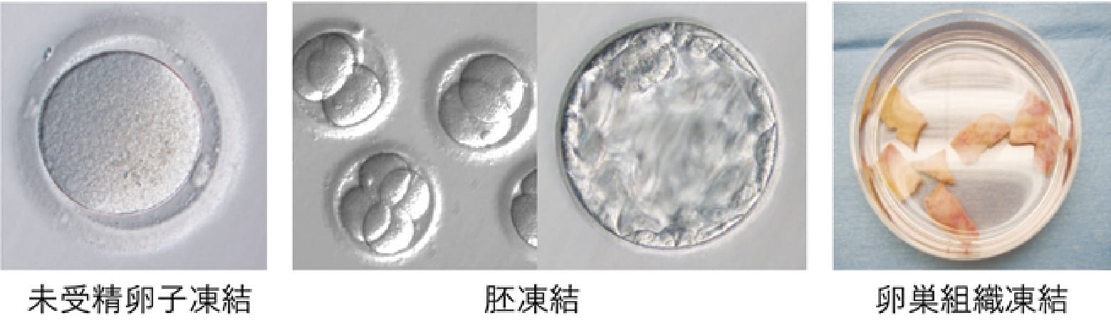 妊孕性温存療法の流れ図