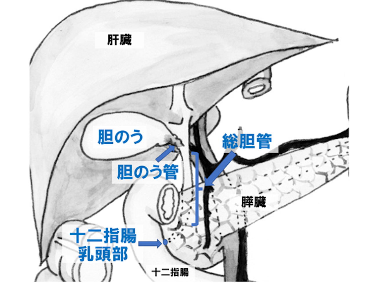 胆道がんの図