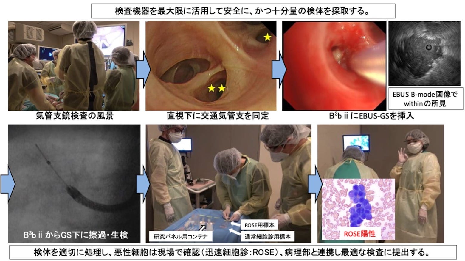 気管支鏡検査の様子