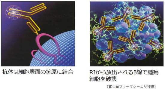 抗体は細胞表面の抗原に結合、RIから放出されるβ線で腫瘍細胞を破壊