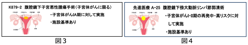 腹腔鏡子宮悪性腫瘍手術について02